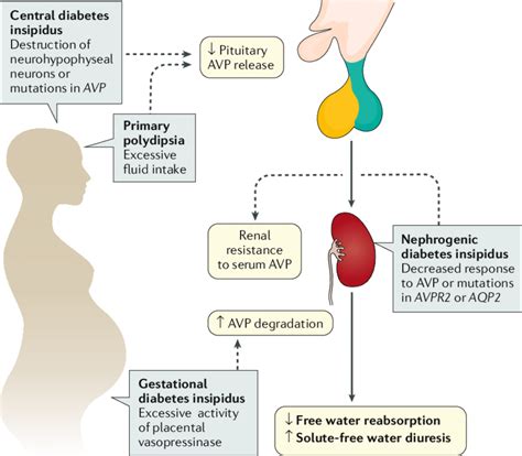 Pathophysiology Of DI Diabetes Insipidus DI Is A Form Of