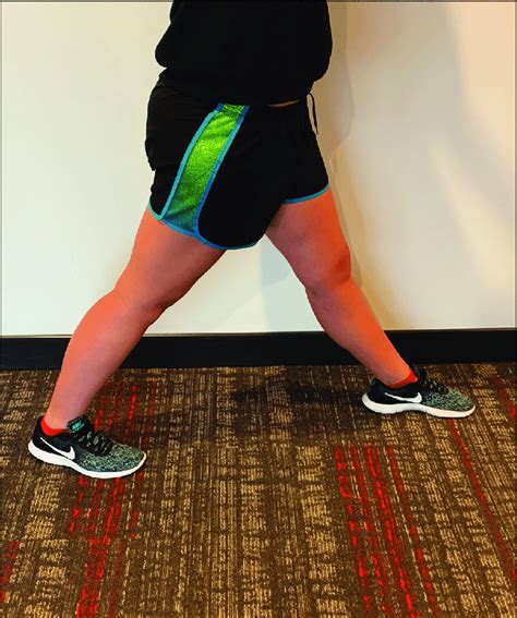 Example Of Reciprocal Stance Position During Which Measurements Were