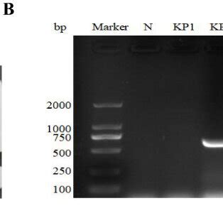 Eric Pcr Banding Fingerprints Of The Kp Strains A Lane M Is The Dna