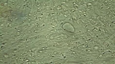 Human Sperm Under Microscope Stock Video Clip K003 6718 Science