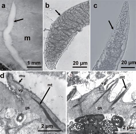 Morphological Characteristics Of Sarcocystis Sp Sarcocysts Isolated Download Scientific