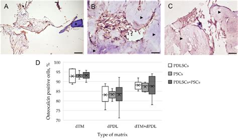 Evaluation of the expression of osteogenic differentiation markers in ...