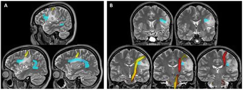 Racgp Functional Magnetic Resonance Imaging In Clinical Practice