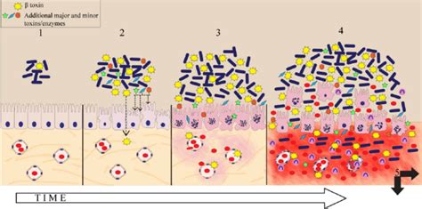 Hypothesis On Key Events Of C Perfringens Type C Induced Necrotizing