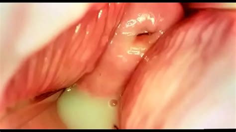 Camera Inside Vagina Filled With Semen Xnxx