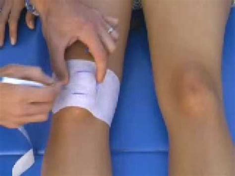 Patellofemoral McConnell Taping YouTube