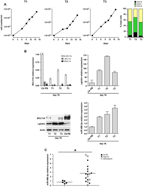 Expression of BCL11A γ globin and miR 486 3p in unilineage erythroid