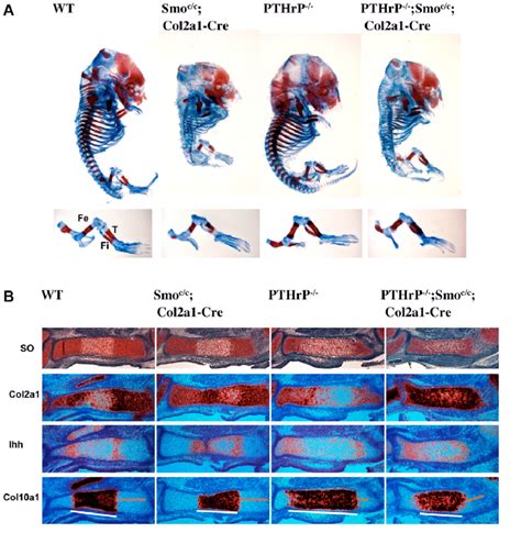 Removal Of Hh Signaling Delays Chondrocyte Hypertrophy In The Absence