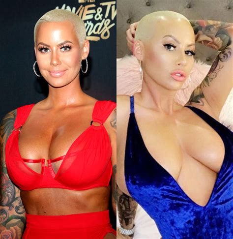 Biggest Breast Reduction Surgery Naked Girls And Their Pussies