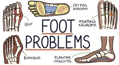 9 Common Foot Problems (Symptoms & Treatment) | Insole Clinic