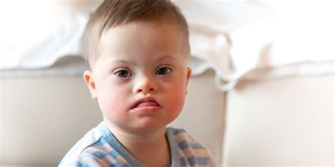 Understanding Down Syndrome A Closer Look Articles Voult