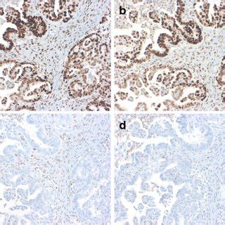 Immunoreactivity Of PD L1 PD L1 Expression In 50 A 25 And