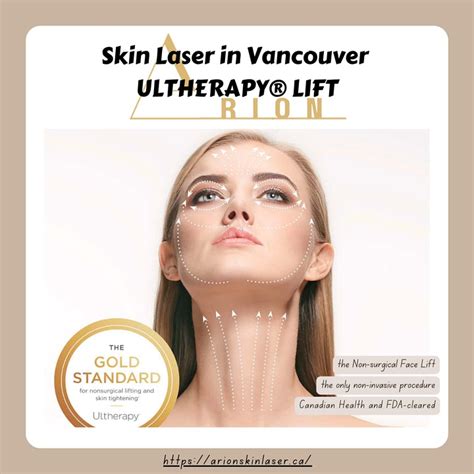 Vancouver Skin Laser Free Photo On Pixabay Pixabay