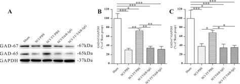 The Western Blot Examination Of Gad 65 And Gad 67 In The Lumbar Spinal Download Scientific