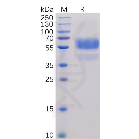 Human CD70 Protein hFc His Tag 专注肿瘤免疫