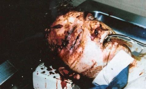 A post mortem photo of Jeffrey Dahmer after being beat to death by ...