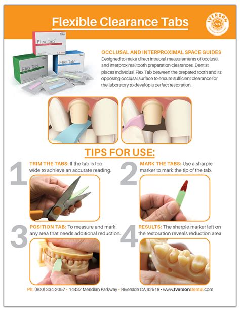 Flexible Clearance Tabs Guide Iverson Dental Labs