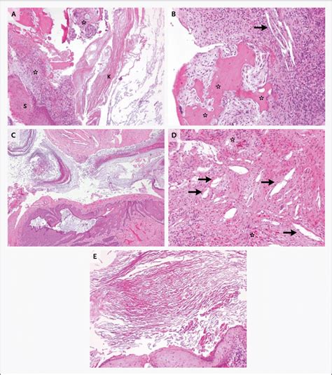 Pathological Examination Of Surgical Specimens Hematoxylin And Eosin