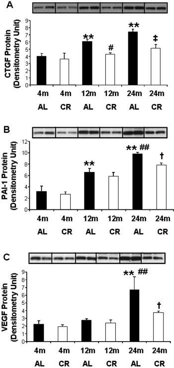 Western Blot Analysis Of The Expression Of Connective Tissue Growth