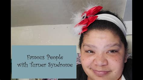 Famous People With Turners Syndrome