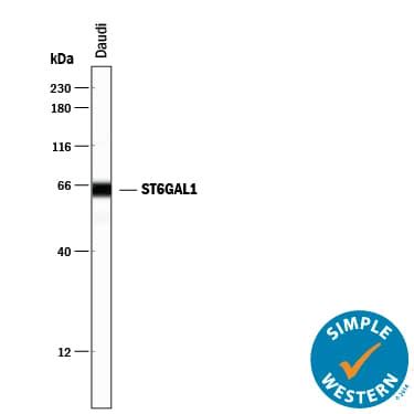 Human ST6 Gal Sialyltransferase 1 ST6GAL1 Antibody AF5924 By R D