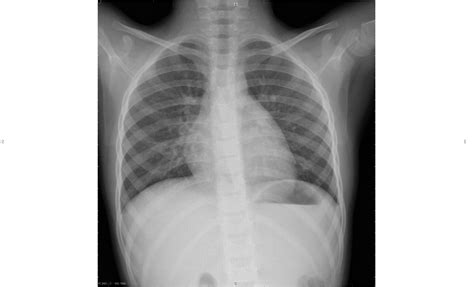 Techniques d imagerie médicale et endoscopie Biotechnologies ST2S