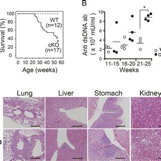 Defective Thymocyte Development In Satb Cko Mice A Expression Of