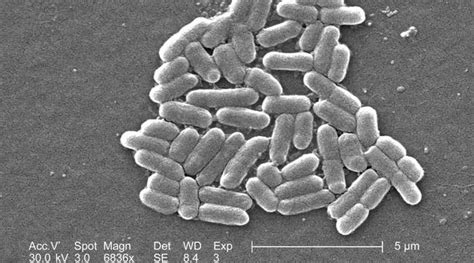 Escherichia Coli Biologia Enem Educa Mais Brasil