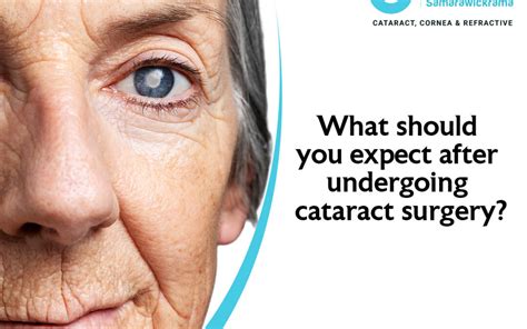 What Should You Expect After Undergoing Cataract Surgery