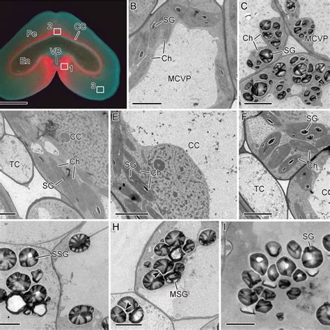 Fluorescence A And Transmission Electron Microscope B I