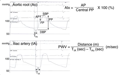 Measurements Of Augmentation Index Aix And Pulse Wave Velocity Download Scientific Diagram