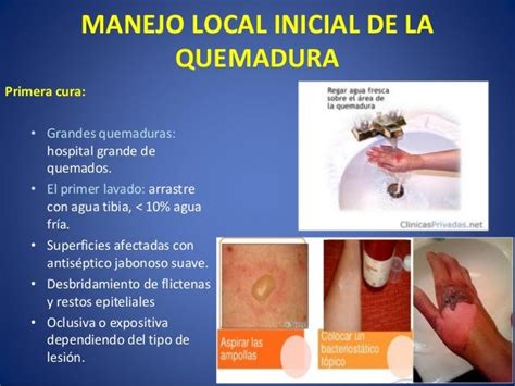 Tratamiento De Las Quemaduras Profilaxis Y Tratamiento