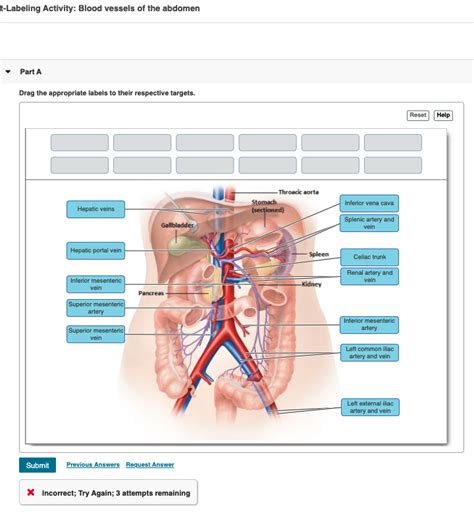 Solved T Labeling Activity Blood Vessels Of The Abdomen Chegg