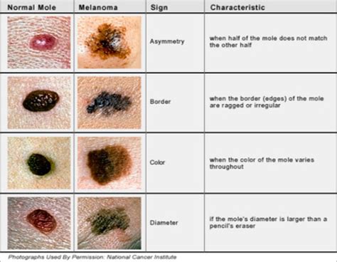 Skin Rash Identification Chart Adults