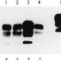 Western Analysis Of Vcjd Brain Homogenates For Prp Sc Using Monoclonal