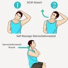 Sternocleidomastoid Muscle Pain - Cause, Symptoms, Treatment