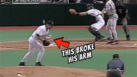 He Broke His Arm Pitching Twice Doctor Explains Rare Mlb Moment