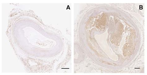 Ijms Free Full Text Anti Atherogenic Effects Of Vaspin On Human