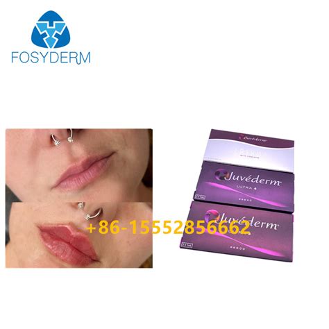 Juvederm Injectable Dermal Filler Ml Hyaluronic Acid