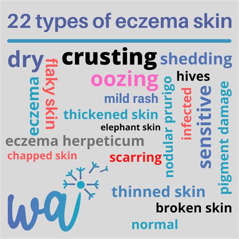 6 Types Of Eczema