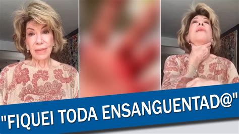 SILVIA POPPOVIC DESABAFA APÓS ASSALTO QUASE ARRANCARAM MINHAS MÃOS