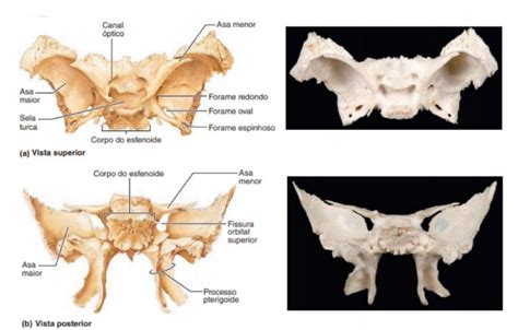 Resumo da anatomia dos ossos do crânio Sanarmed