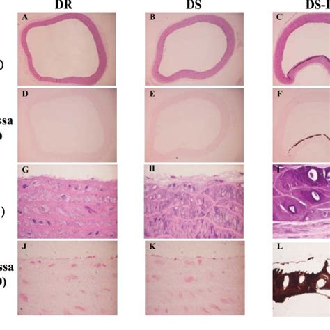 Hande And Von Kossa Staining Of Arcuate Aorta In Dr Ds And Ds Is Rats Download Scientific Diagram