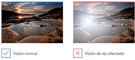 Cómo Actuar Ante La Visión De Destellos Luminosos