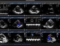 Ultralinq Strutture Medico Tecniche Medicalexpo