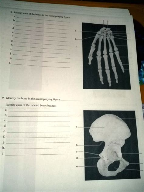 SOLVED Identily Cach Of The Bones Thc Accoinanvin Tigure Identify The