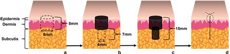 Recommendations For An Approach To Random Skin Biopsy In The Diagnosis