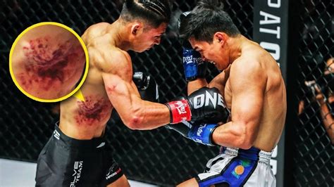 Leg Kicks FROM HELL Akimoto Vs Petchtanong Was BRUTAL Vidio