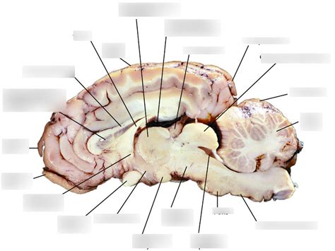 CH 13 Sheep Brain Sagittal View Diagram Quizlet