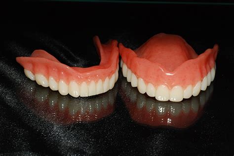 Ivoclar Digital Denture - Burbank Dental Lab